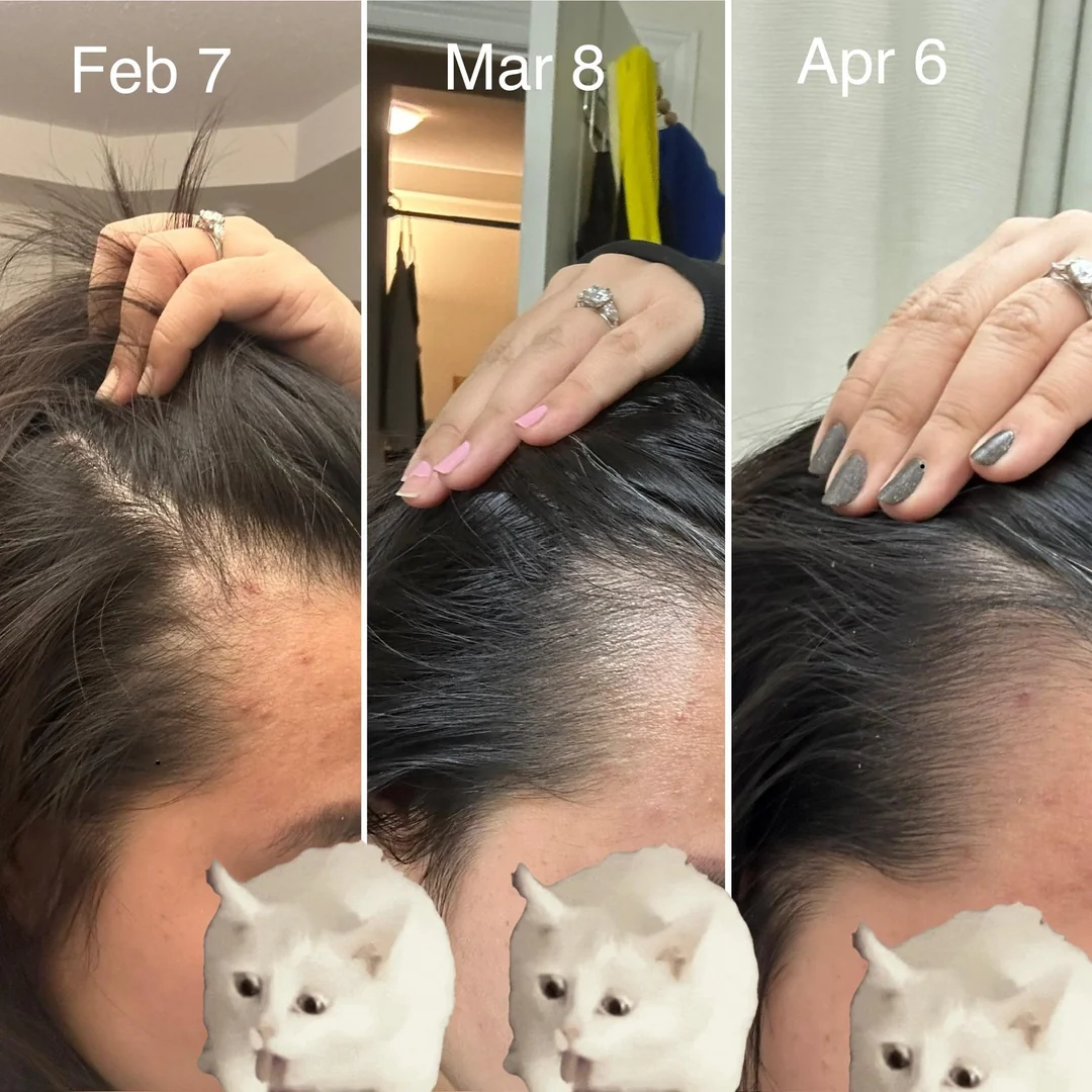 Resultado após 2 meses de tratamento